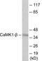 Pregnancy Up-Regulated Nonubiquitous CaM Kinase antibody, EKC1856, Boster Biological Technology, Western Blot image 