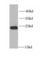 Mitotic spindle assembly checkpoint protein MAD2B antibody, FNab04926, FineTest, Western Blot image 
