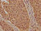Karyopherin Subunit Beta 1 antibody, CSB-PA622929LA01HU, Cusabio, Immunohistochemistry frozen image 