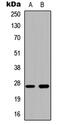 Cathepsin Z antibody, abx121463, Abbexa, Western Blot image 