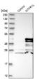 Mitochondrial Fission Regulator 1 Like antibody, NBP1-86400, Novus Biologicals, Western Blot image 