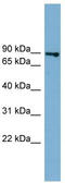 FAST Kinase Domains 2 antibody, TA334564, Origene, Western Blot image 