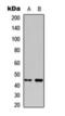 Inhibin Subunit Beta B antibody, orb393082, Biorbyt, Western Blot image 
