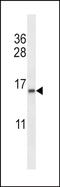 Elongin B antibody, PA5-48686, Invitrogen Antibodies, Western Blot image 