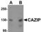 Microtubule Associated Scaffold Protein 2 antibody, TA306938, Origene, Western Blot image 