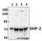 PTPN11 antibody, A00150S350, Boster Biological Technology, Western Blot image 