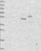 DMRT Like Family A2 antibody, NBP1-85830, Novus Biologicals, Western Blot image 