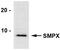 Small muscular protein antibody, PA3-070, Invitrogen Antibodies, Western Blot image 