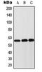 Keratin 8 antibody, LS-B16087, Lifespan Biosciences, Western Blot image 