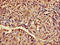Ataxin 3 antibody, CSB-PA002443LA01HU, Cusabio, Immunohistochemistry frozen image 