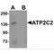 ATPase Secretory Pathway Ca2+ Transporting 2 antibody, MBS150680, MyBioSource, Western Blot image 