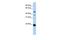 Zinc Finger DHHC-Type Containing 14 antibody, GTX46989, GeneTex, Western Blot image 