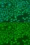 hNinein antibody, GTX64771, GeneTex, Immunofluorescence image 