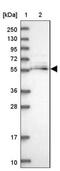 Mannosyl (Alpha-1,6-)-Glycoprotein Beta-1,2-N-Acetylglucosaminyltransferase antibody, NBP2-14235, Novus Biologicals, Western Blot image 