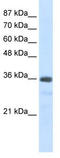 Small Nuclear Ribonucleoprotein U11/U12 Subunit 35 antibody, TA345994, Origene, Western Blot image 