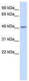 5-Hydroxytryptamine Receptor 5A antibody, TA329997, Origene, Western Blot image 