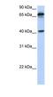 MHC Class I Polypeptide-Related Sequence A antibody, NBP1-59184, Novus Biologicals, Western Blot image 