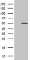 5-aminolevulinate synthase, erythroid-specific, mitochondrial antibody, TA809959, Origene, Western Blot image 