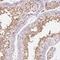 Nucleoporin 210 Like antibody, NBP2-49488, Novus Biologicals, Immunohistochemistry paraffin image 