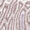 Zinc Finger Protein 488 antibody, HPA044867, Atlas Antibodies, Immunohistochemistry paraffin image 