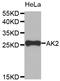 Adenylate kinase 2, mitochondrial antibody, STJ22561, St John