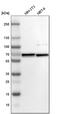 CWC27 Spliceosome Associated Cyclophilin antibody, PA5-54184, Invitrogen Antibodies, Western Blot image 
