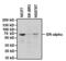 Estrogen Receptor 1 antibody, GTX22746, GeneTex, Western Blot image 