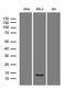 HPV18 E7 antibody, LS-C795925, Lifespan Biosciences, Western Blot image 