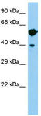 Wnt Family Member 8B antibody, TA344460, Origene, Western Blot image 