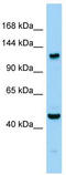 Cytosolic carboxypeptidase 1 antibody, TA333691, Origene, Western Blot image 