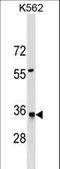 HL antibody, LS-C159851, Lifespan Biosciences, Western Blot image 