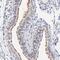 RIB43A Domain With Coiled-Coils 2 antibody, PA5-51861, Invitrogen Antibodies, Immunohistochemistry paraffin image 