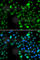 Inhibitor of growth protein 5 antibody, A7288, ABclonal Technology, Immunofluorescence image 