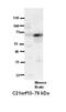 Lebercilin LCA5 Like antibody, NBP1-70597, Novus Biologicals, Western Blot image 