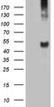 Tyrosine Aminotransferase antibody, LS-C792278, Lifespan Biosciences, Western Blot image 