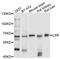 Lipolysis Stimulated Lipoprotein Receptor antibody, STJ111665, St John