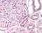 Suppression Of Tumorigenicity 14 antibody, orb86970, Biorbyt, Immunohistochemistry paraffin image 