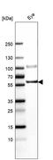 Ectonucleoside Triphosphate Diphosphohydrolase 2 antibody, HPA017676, Atlas Antibodies, Western Blot image 