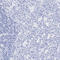 Keratin 19 antibody, HPA002465, Atlas Antibodies, Immunohistochemistry frozen image 