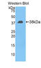 EGF Containing Fibulin Extracellular Matrix Protein 2 antibody, LS-C713365, Lifespan Biosciences, Western Blot image 