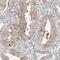 Centrosomal Protein 162 antibody, NBP1-91158, Novus Biologicals, Immunohistochemistry paraffin image 