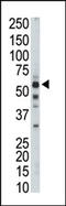 Pyruvate Kinase L/R antibody, AP13594PU-N, Origene, Western Blot image 
