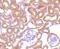 Leucine Rich Repeat Kinase 1 antibody, NBP2-75556, Novus Biologicals, Immunohistochemistry paraffin image 