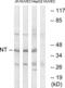 hNT antibody, abx014665, Abbexa, Western Blot image 