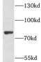 Metal transporter CNNM3 antibody, FNab01803, FineTest, Western Blot image 