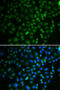 SS-A antibody, 15-060, ProSci, Immunofluorescence image 
