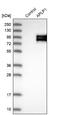 Amyloid Beta Precursor Like Protein 1 antibody, NBP1-89036, Novus Biologicals, Western Blot image 