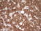 Leucine Rich Repeat Containing 6 antibody, LS-C339843, Lifespan Biosciences, Immunohistochemistry paraffin image 