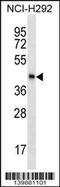 Sperm equatorial segment protein 1 antibody, 60-308, ProSci, Western Blot image 