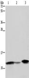 Fatty Acid Binding Protein 2 antibody, TA351301, Origene, Western Blot image 
